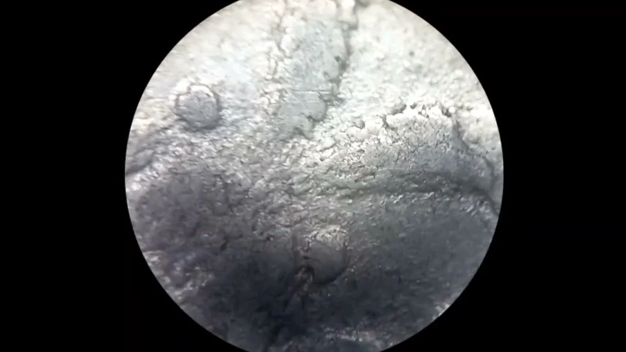 Assessing the condition under a microscope